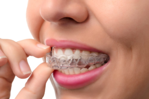 Dentist Clinton Can Advise on Whether to Go For Dentures or Dental Implants