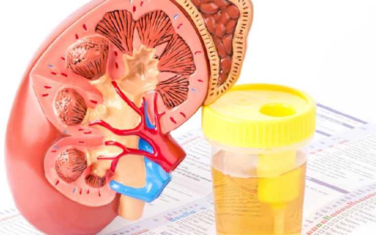 Detection of kidney disorders through urine collection