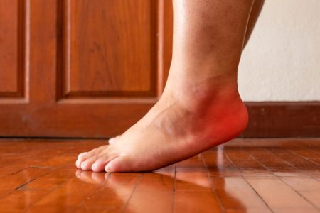 Plantar fasciitis disorder